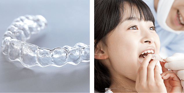 矯正治療 ORTHODONTICS 写真